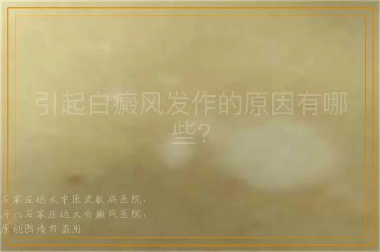 引起白癜风发作的原因有哪些?