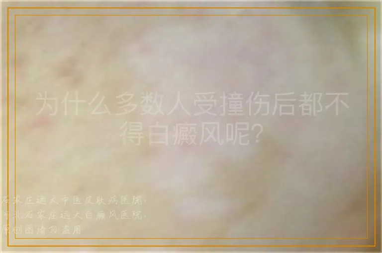 为什么多数人受撞伤后都不得白癜风呢？