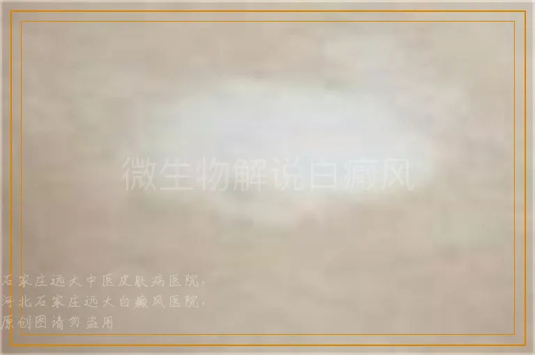 微生物解说白癜风