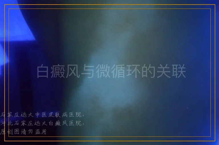 白癜风与微循环的关联