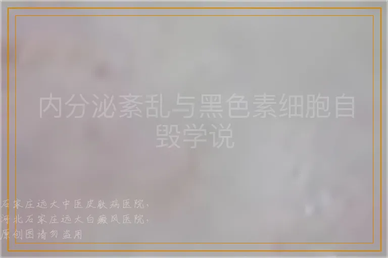 内分泌紊乱与黑色素细胞自毁学说