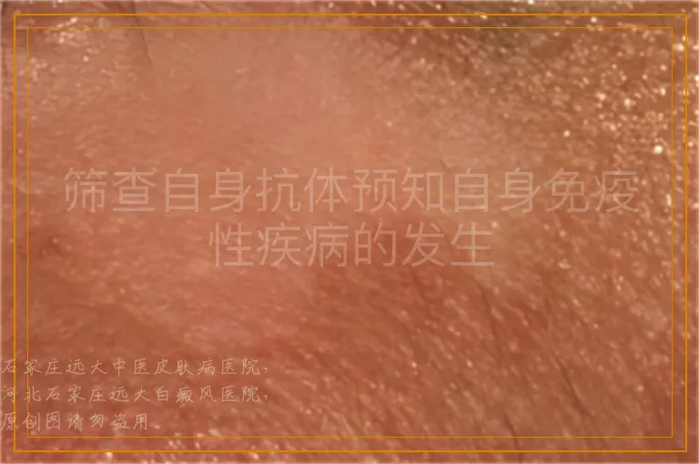 筛查自身抗体预知自身免疫性疾病的发生