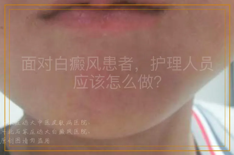 面对白癜风患者，护理人员应该怎么做？