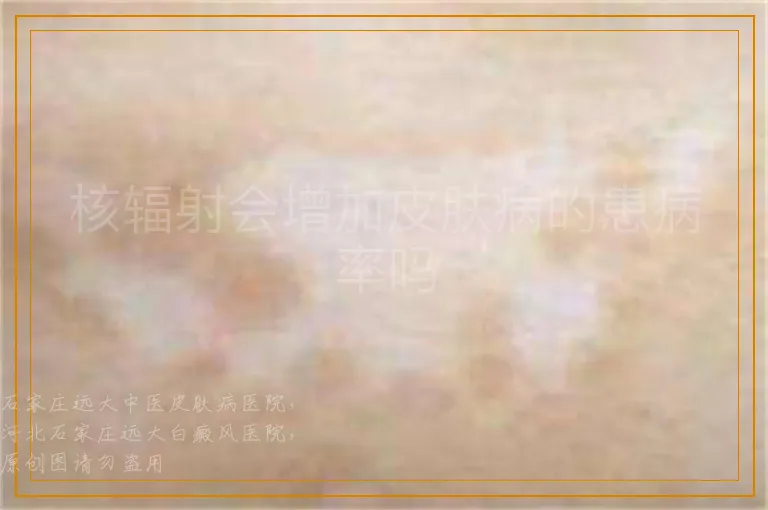 核辐射会增加皮肤病的患病率吗