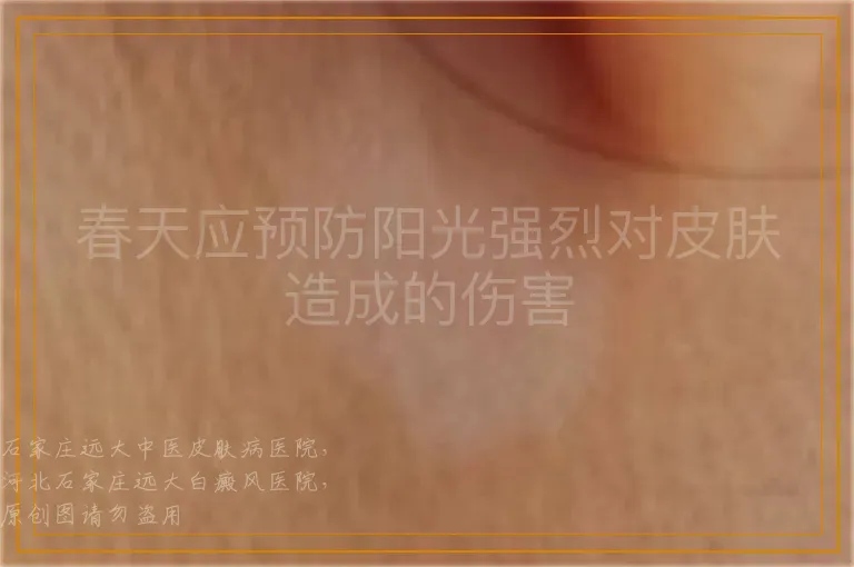 春天应预防阳光强烈对皮肤造成的伤害