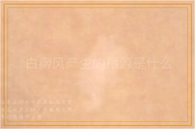 白癜风产生的根源是什么