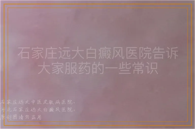 石家庄远大白癜风医院告诉大家服药的一些常识