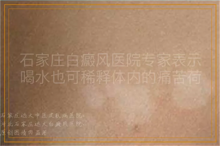 石家庄白癜风医院专家表示喝水也可稀释体内的痛苦荷尔蒙