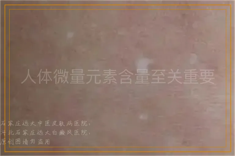 人体微量元素含量至关重要