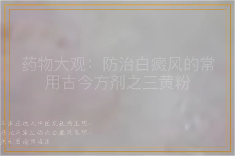 药物大观：防治白癜风的常用古今方剂之三黄粉