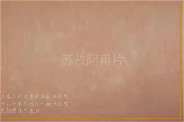 苏孜阿甫片