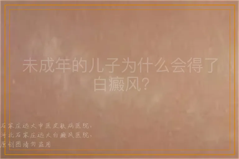 未成年的儿子为什么会得了白癜风？