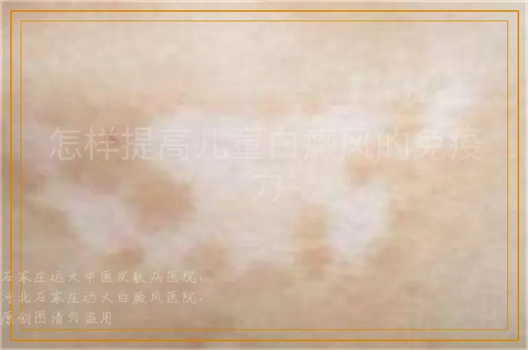 怎样提高儿童白癜风的免疫力