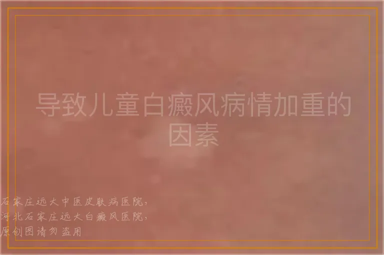 导致儿童白癜风病情加重的因素