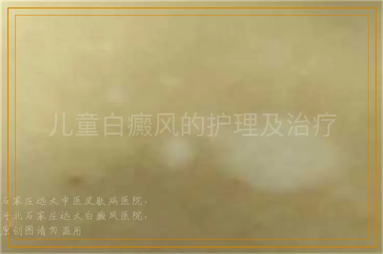 儿童白癜风的护理及治疗