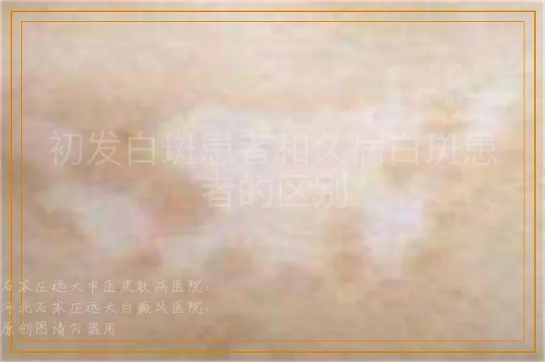 初发白斑患者和久病白斑患者的区别