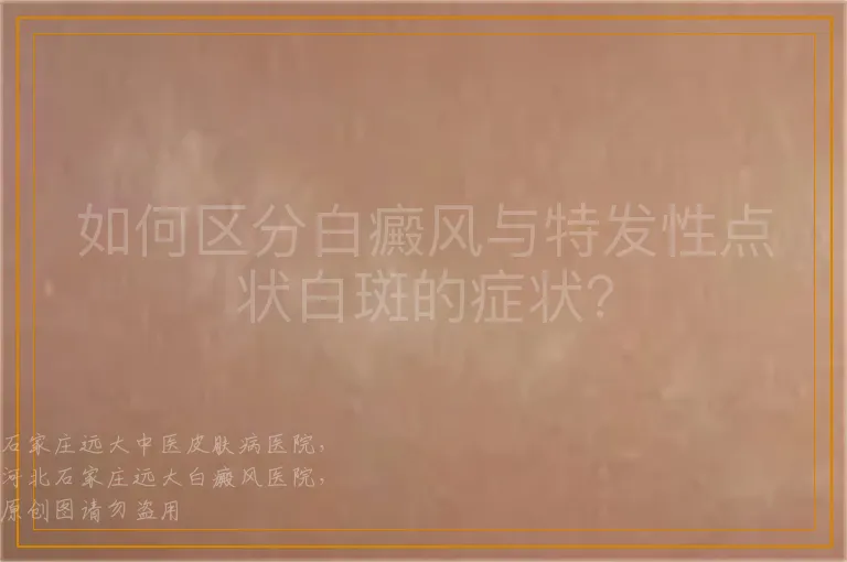 如何区分白癜风与特发性点状白斑的症状？