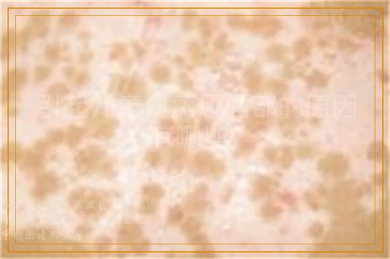 引起儿童白癜风面部的原因有哪些？