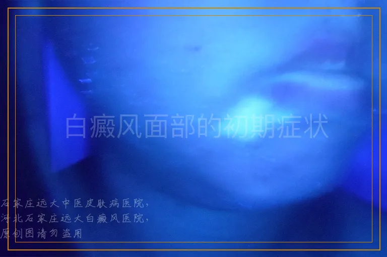 白癜风面部的初期症状