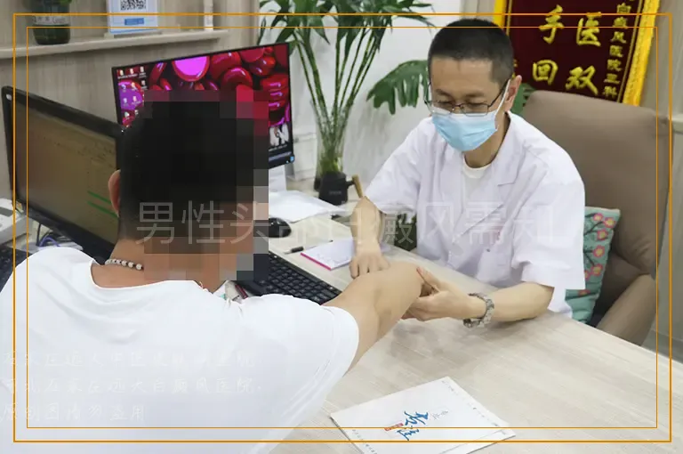 男性头部白癜风需知
