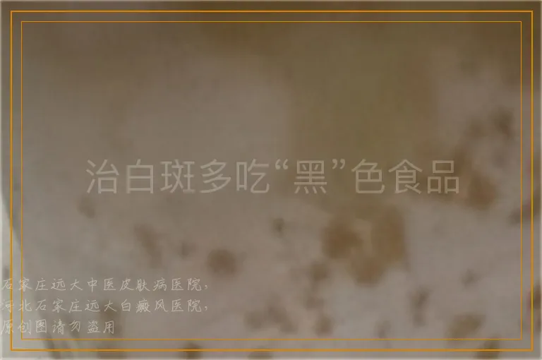 治白斑多吃“黑”色食品