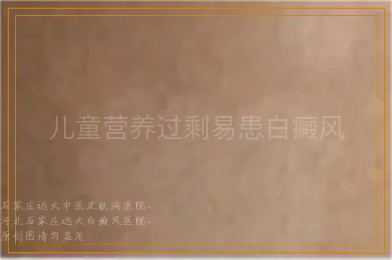 儿童营养过剩易患白癜风