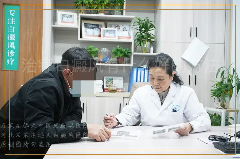 治疗白癜风有什么好的方法？