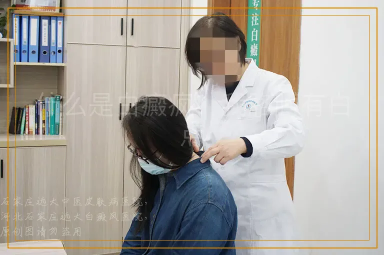 什么是白癜疯？我胳膊有白点