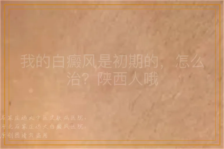 我的白癜风是初期的，怎么治？陕西人哦