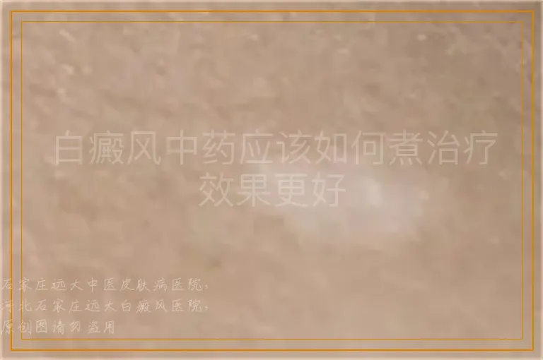 白癜风中药应该如何煮治疗效果更好