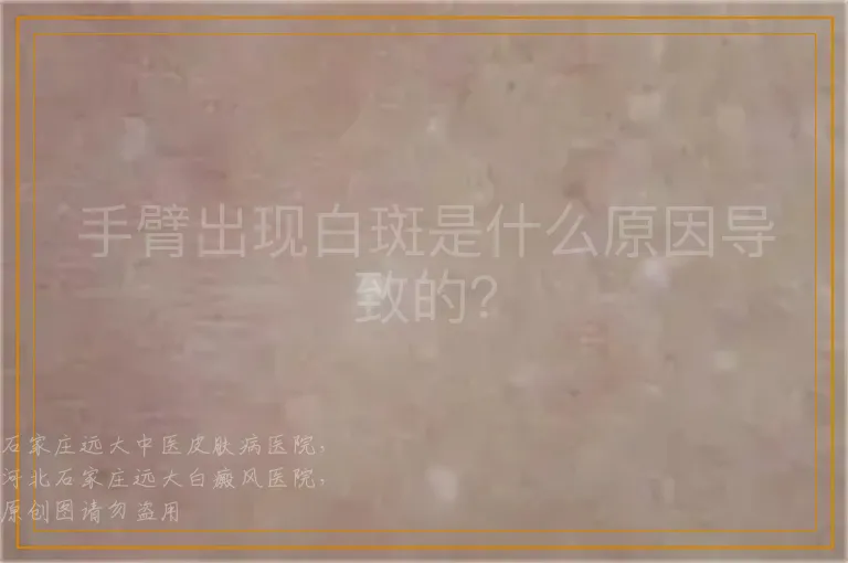 手臂出现白斑是什么原因导致的？