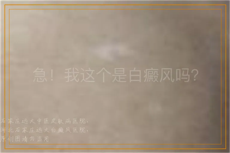 急！我这个是白癜风吗？