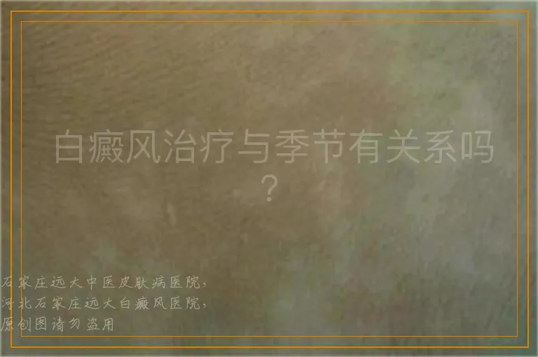 白癜风治疗与季节有关系吗？