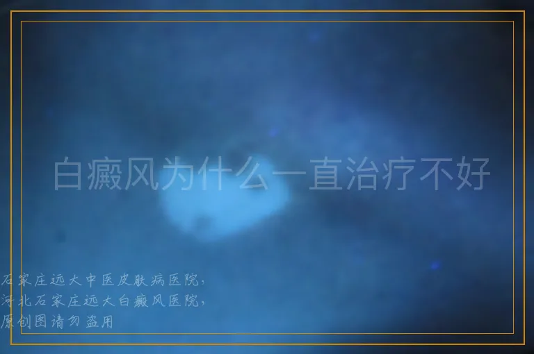 白癜风为什么一直治疗不好