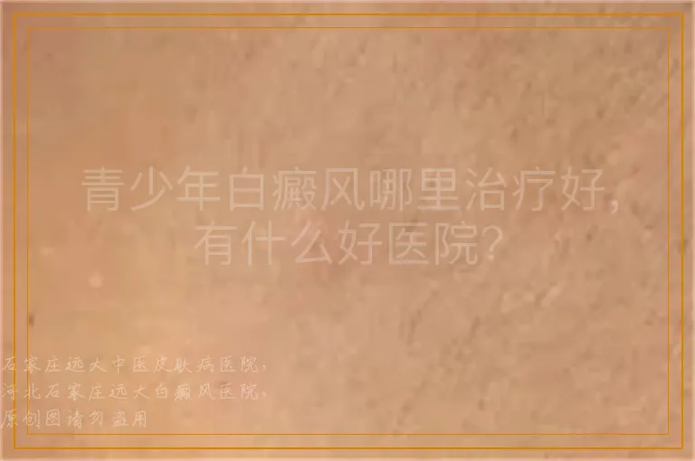 青少年白癜风哪里治疗好，有什么好医院？