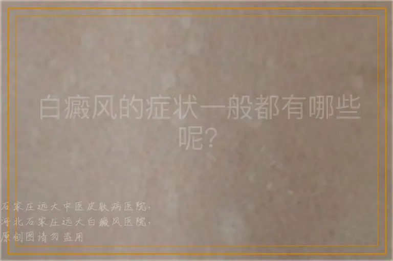 白癜风的症状一般都有哪些呢？