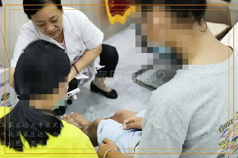 白癜风问题？