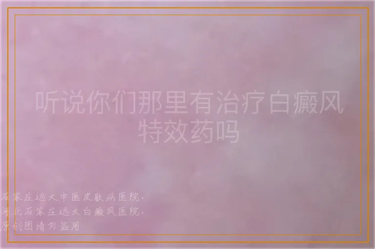听说你们那里有治疗白癜风特效药吗