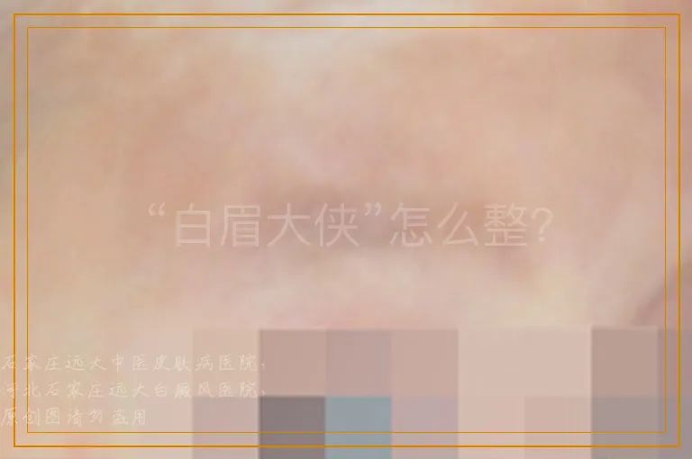 “白眉大侠”怎么整？