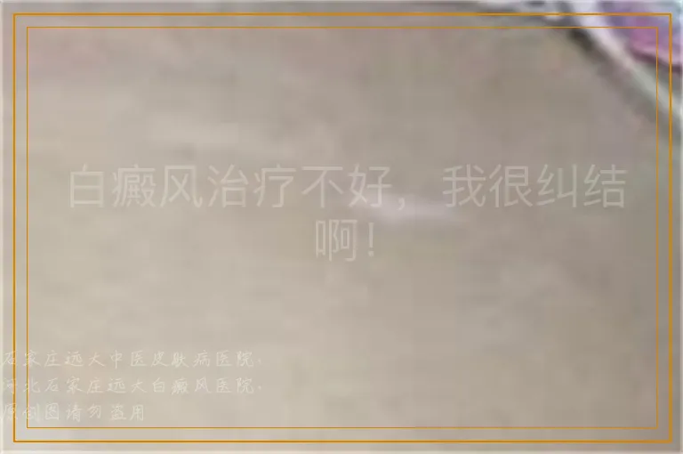 白癜风治疗不好，我很纠结啊！