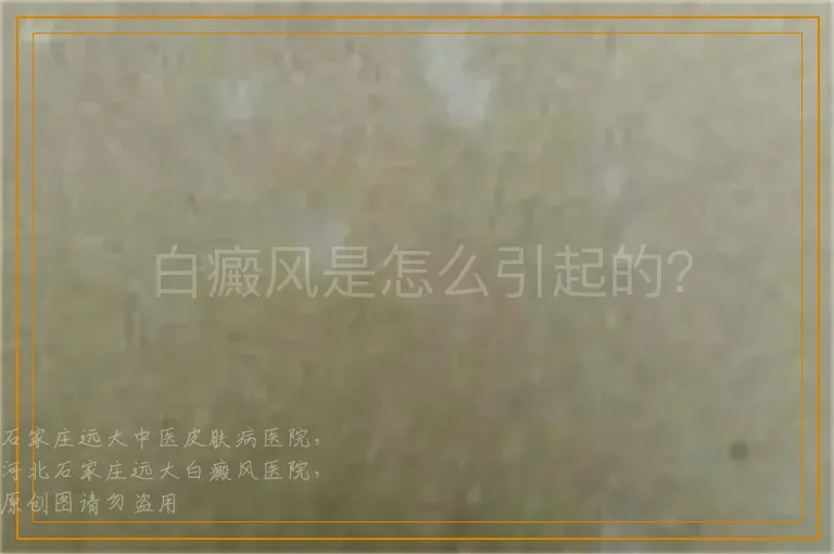 白癜风是怎么引起的？