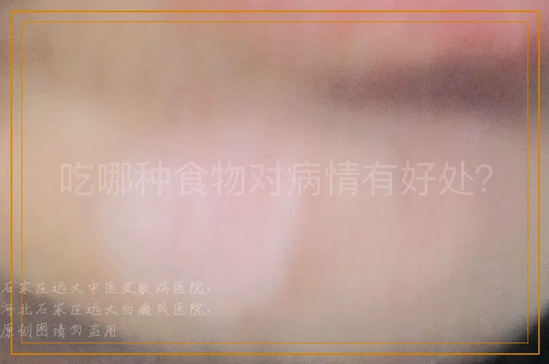 吃哪种食物对病情有好处？