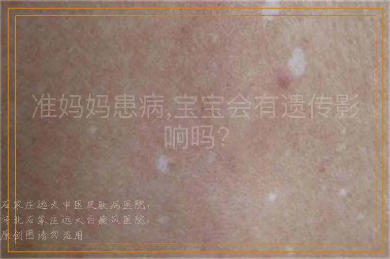 准妈妈患病,宝宝会有遗传影响吗？
