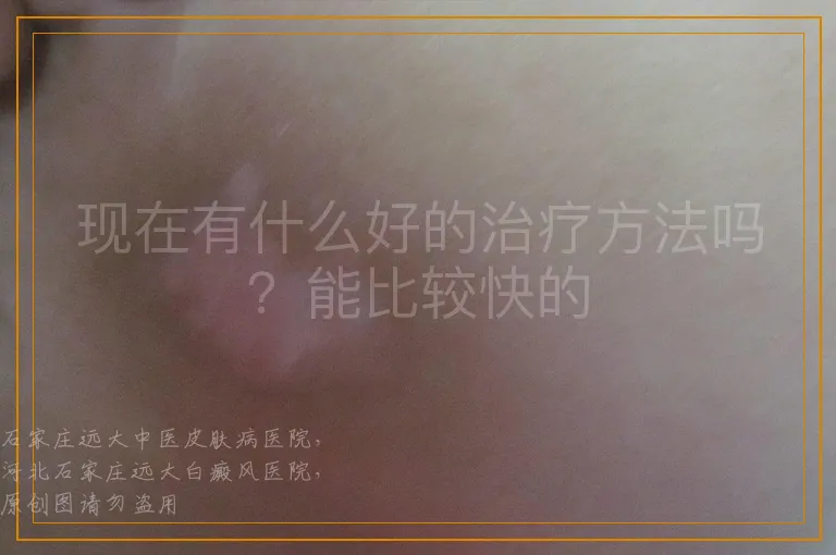 现在有什么好的治疗方法吗？能比较快的