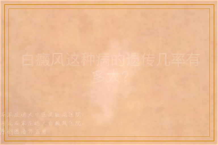 白癜风这种病的遗传几率有多大?