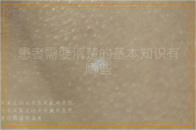 患者需要清楚的基本知识有哪些