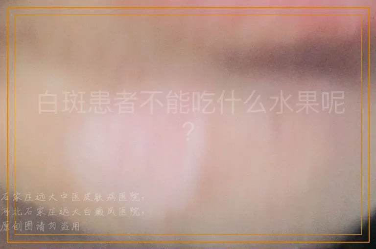 白斑患者不能吃什么水果呢？