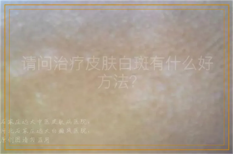 请问治疗皮肤白斑有什么好方法？