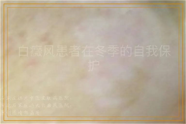 白癜风患者在冬季的自我保护