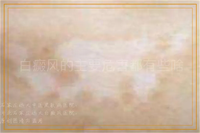 白癜风的主要危害都有些啥